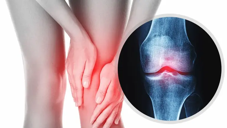 Najčešći problemi sa zglobovima i kako ih spriječiti